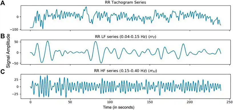 HRV Tachogram